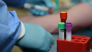 GGD test zorgmedewerkers op coronabesmetting
